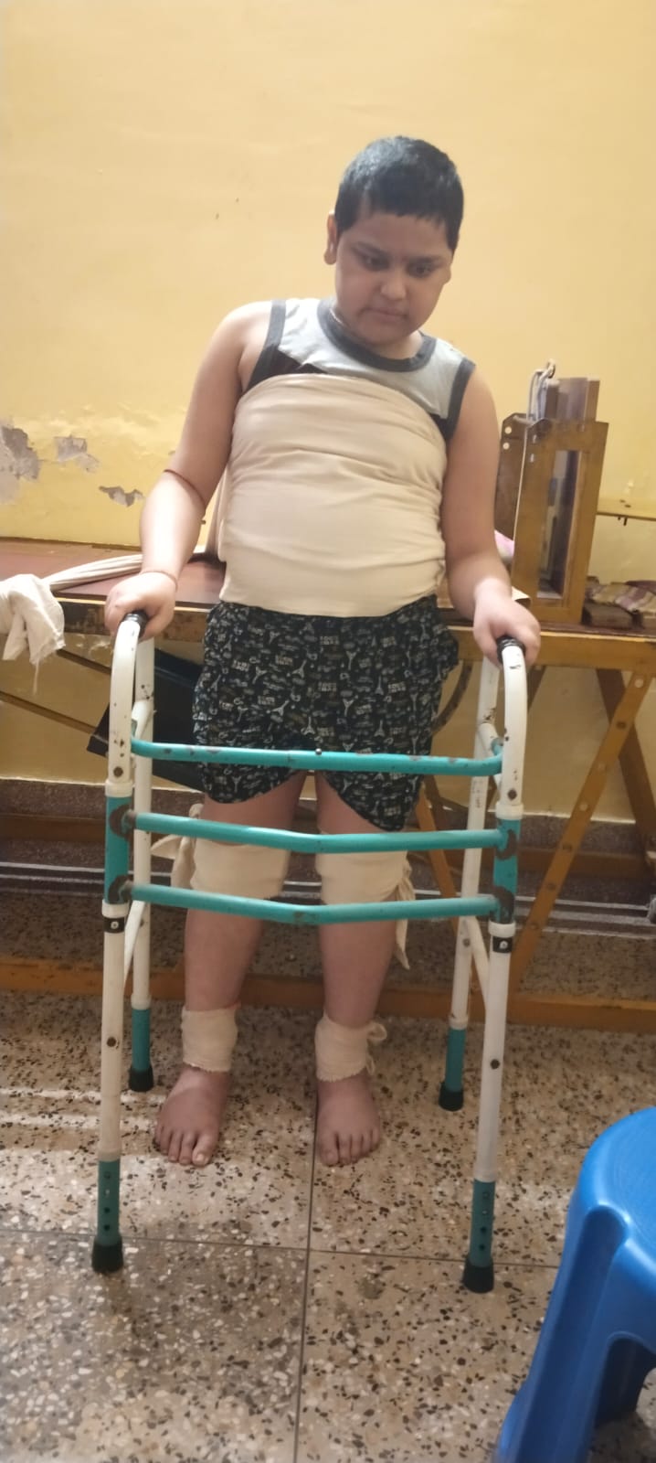Overcoming Duchenne Muscular Dystrophy